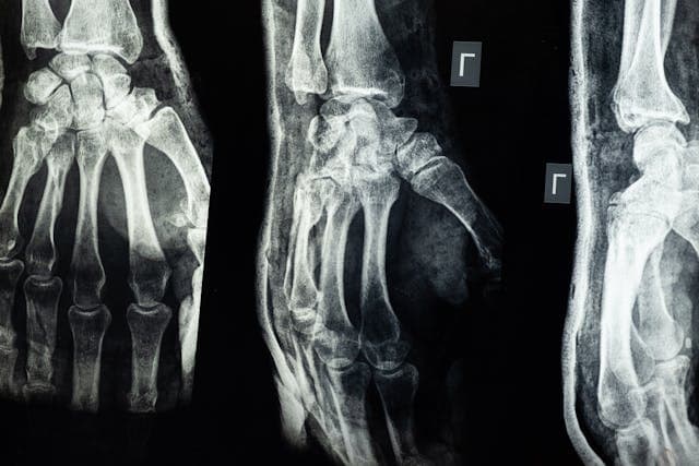How to Build a Bulletproof Injury Claim from Day One